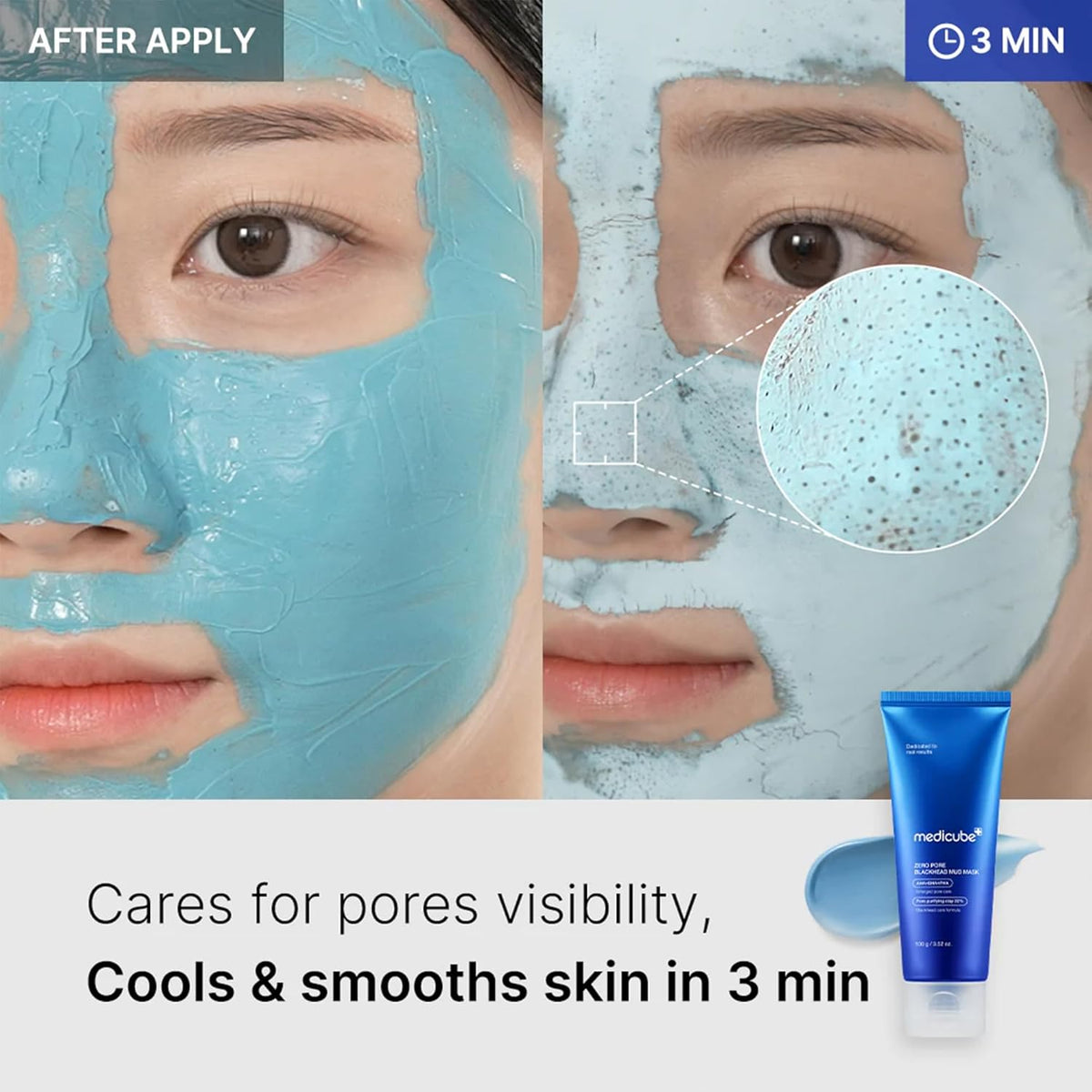 medicube Zero Pore Blackhead Mud Mask – 100g