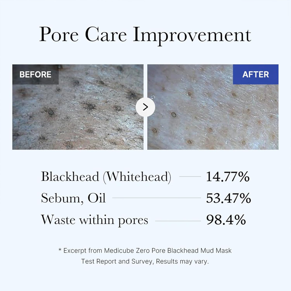 medicube Zero Pore Blackhead Mud Mask – 100g