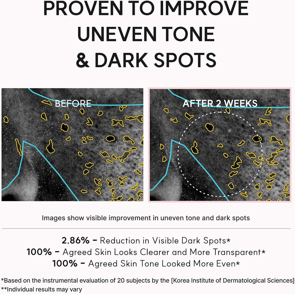 Arencia TXA Booster Shot | Intensive Dark Spot Correcting Serum 30ml