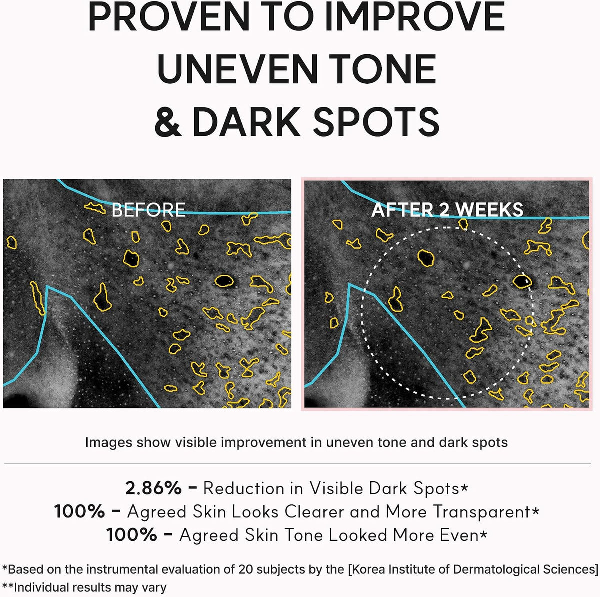 Arencia TXA Booster Shot | Intensive Dark Spot Correcting Serum 30ml