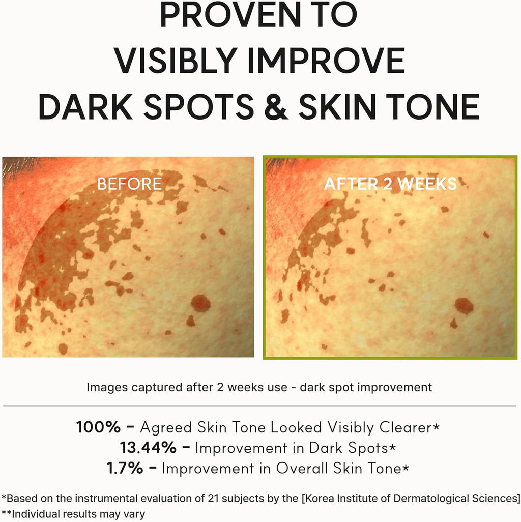 Before and after comparison of dark spots on skin with text indicating improvement.