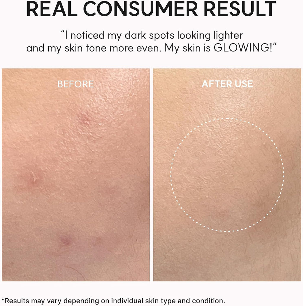 Arencia TXA Booster Shot | Intensive Dark Spot Correcting Serum 30ml