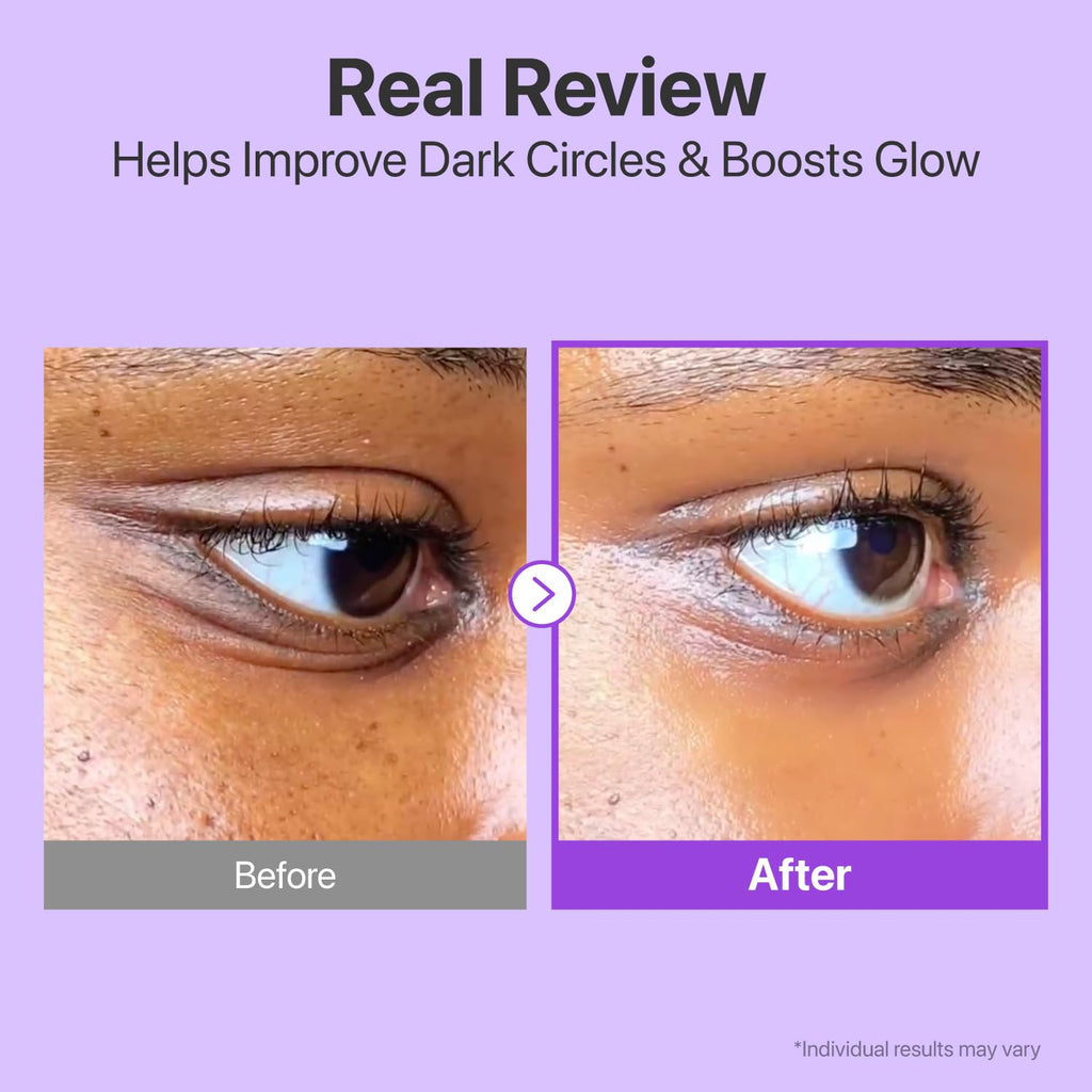 Before and after comparison of dark circles improvement with text 'Real Review' and 'Helps Improve Dark Circles & Boosts Glow'.